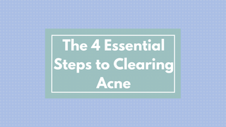 The 4 Essential Steps to Clearing Acne (That Most People Miss!)